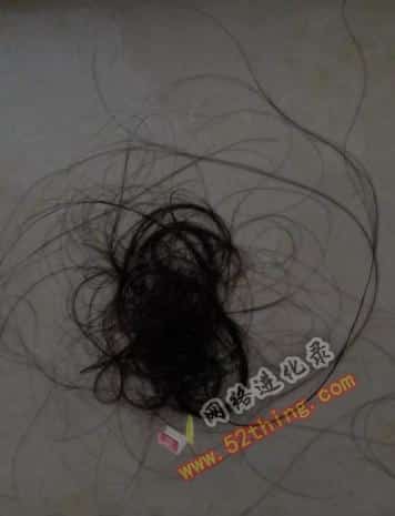脱发怎么办（脱发是什么原因引起的）