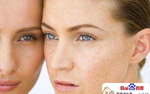 祛斑多少钱（祛斑目前最有效的方法）