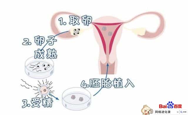 试管婴儿的危害（试管婴儿的利弊有哪些?）